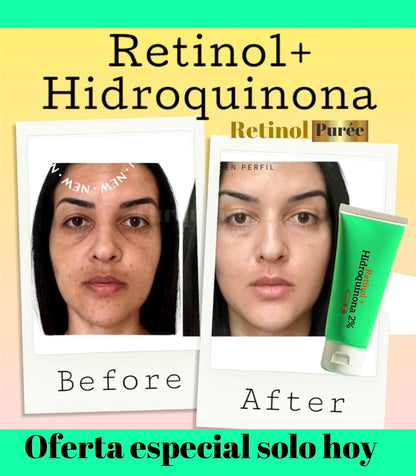 RETINOL+ HIDROQUINONA2%  Vitamina E,B5 es una solución efectiva que Combate MANCHAS/ e hiperpigmentación