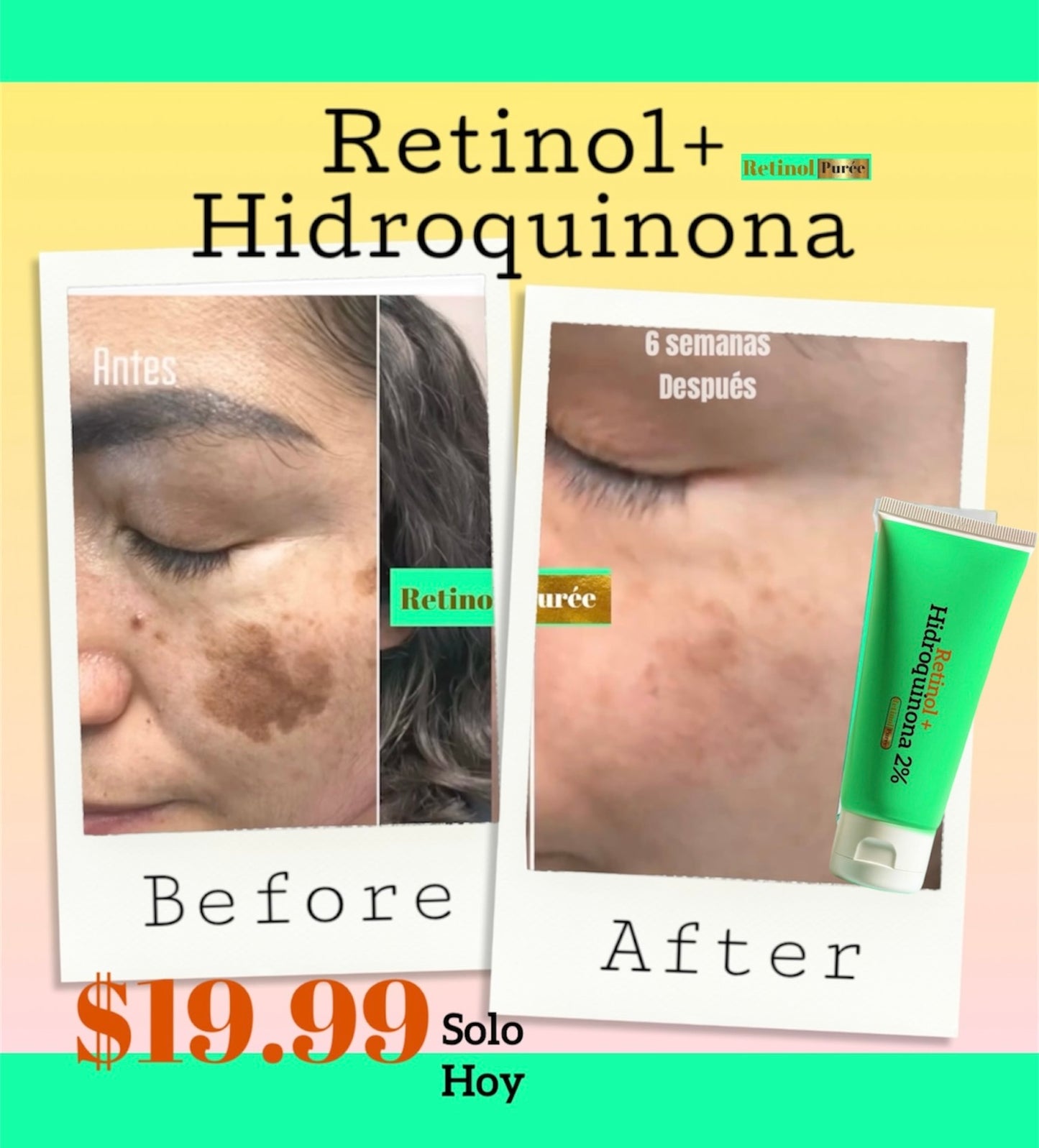 RETINOL+ HIDROQUINONA2%  Vitamina E,B5 es una solución efectiva que Combate MANCHAS/ e hiperpigmentación