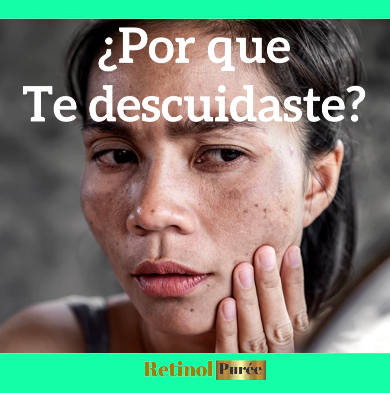 RETINOL+ HIDROQUINONA2%  Vitamina E,B5 es una solución efectiva que Combate MANCHAS/ e hiperpigmentación