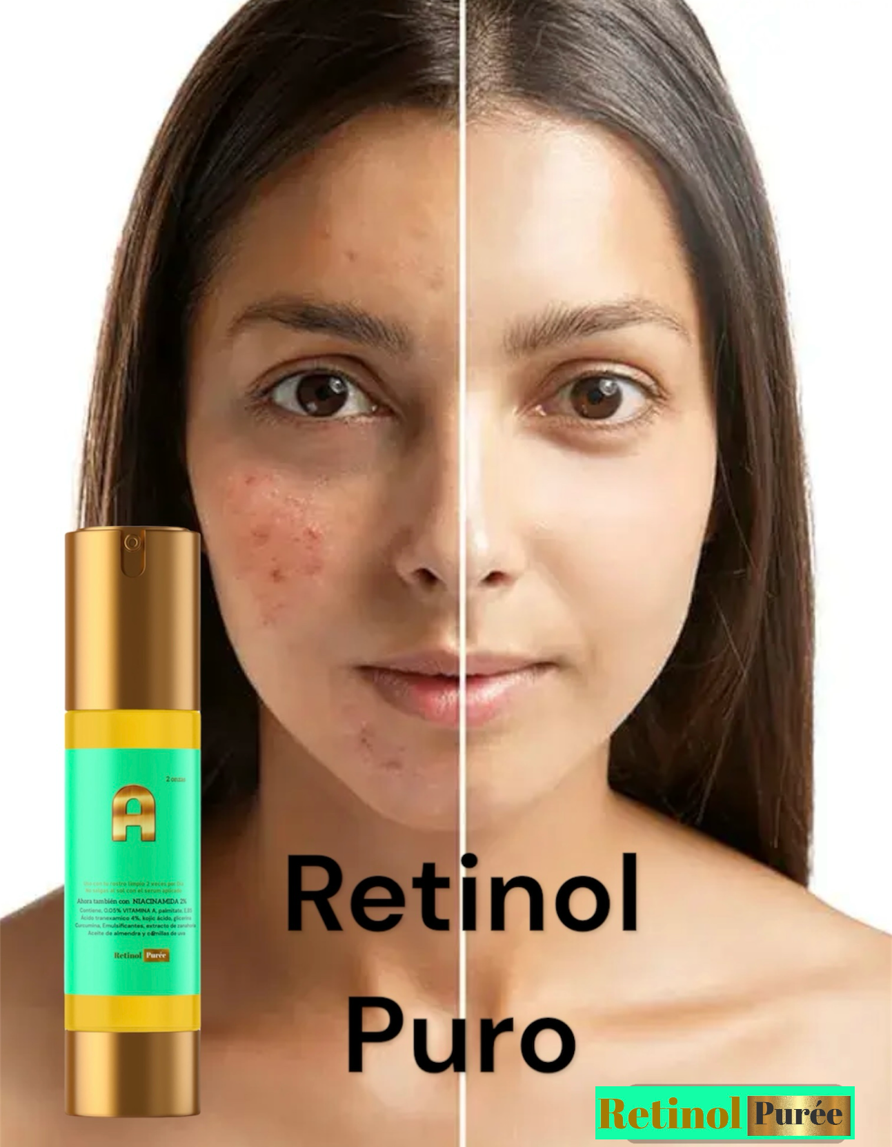 Borra Arrugas y cicatrices tratamiento completo de Retinol, niacinamida para piel desidratada y vieja,y limpiador 100% efectivo cleanser de acido kojico, Vitamina E con propóleos